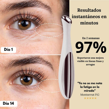 DermaPen™ - Elimina Ojeras y Bolsas en sólo 7 días
