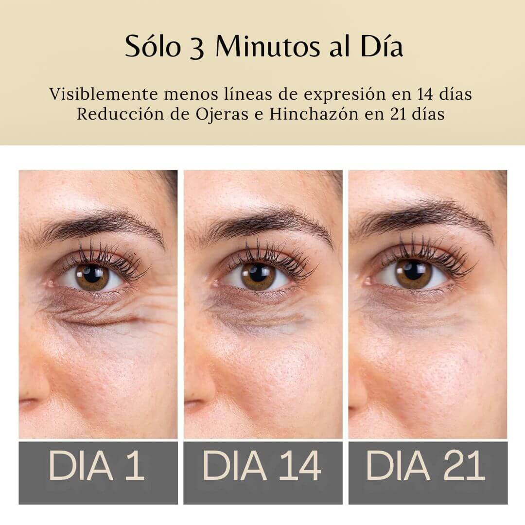 DermaPen™ - Elimina Ojeras y Bolsas en sólo 7 días
