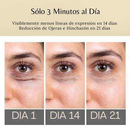 DermaPen™ - Elimina Ojeras y Bolsas en sólo 7 días