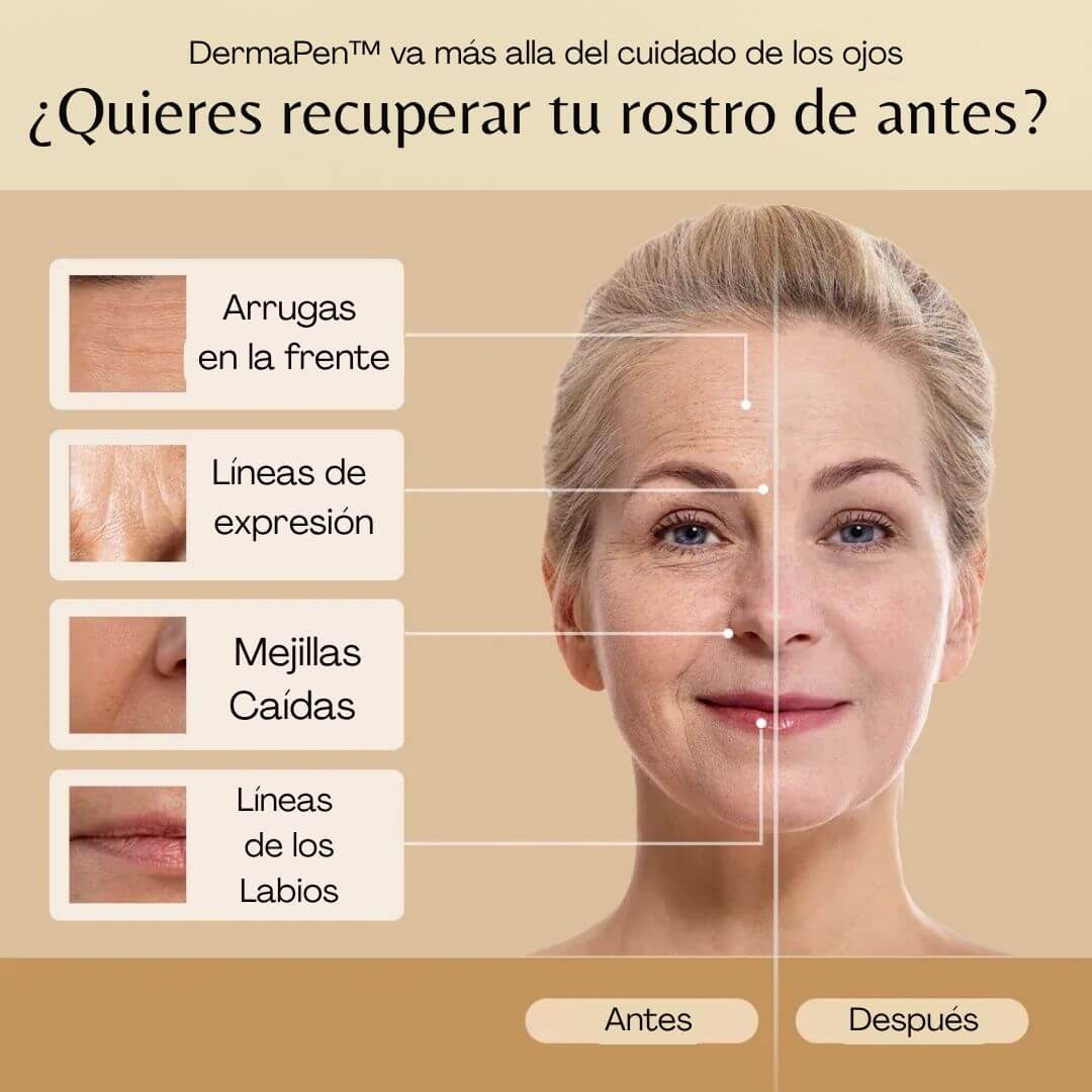 DermaPen™ - Elimina Ojeras y Bolsas en sólo 7 días