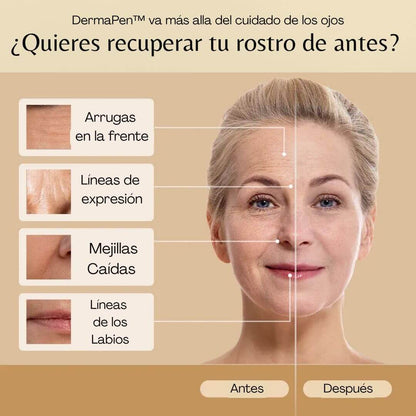 DermaPen™ - Elimina Ojeras y Bolsas en sólo 7 días